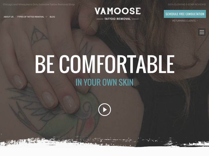 Vamoose Tattoo Removal