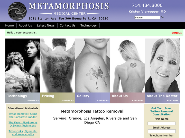 Metamorphosis Tattoo Removal